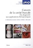 Les cancers de la cavit� buccale : Du diagnostic aux applications th�rapeutiques