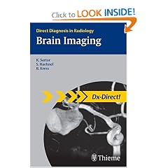Brain Imaging (Direct Diagnosis in Radiology) by Klaus Sartor, Stefan Haehnel and Bodo Kress