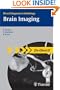 Brain Imaging (Direct Diagnosis in Radiology)