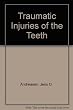 Traumatic injuries of the teeth