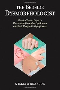 the bedside dysmorphologist - william reardon the bedside dysmorphologist - william reardon