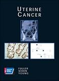Uterine Cancer (American Cancer Society Atlas of Clinical Oncology)