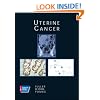 Uterine Cancer (American Cancer Society Atlas of Clinical Oncology)