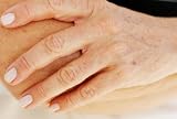 removing age spots