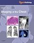 Imaging of the Chest, 2-Volume Set: Expert Radiology Series, 1e