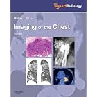 Click here to buy Imaging of the Chest, 2-Volume Set: Expert Radiology Series by Nestor L. Muller MD PhD and C. Isabela S. Silva MD PhD.