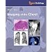 Imaging of the Chest, 2-Volume Set: Expert Radiology Series, 1e