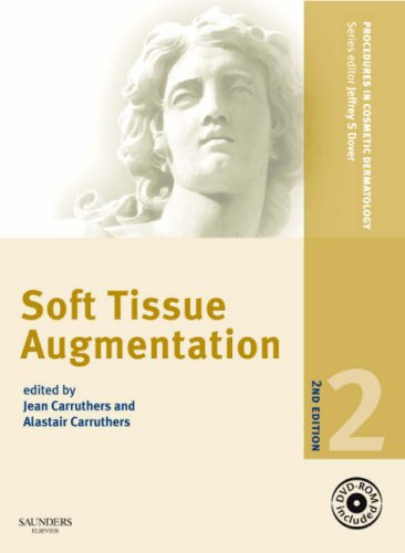 Procedures in Cosmetic Dermatology Series: Soft Tissue Augmentation with DVD