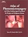 Atlas of Phonomicrosurgery & Other Endolaryngeal Procedures for Benign & Malignant Disease
