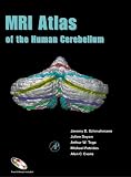 MRI Atlas of the Human Cerebellum