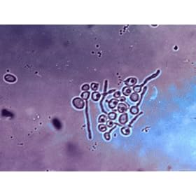 Candida Albicans Germ Tube Photographic Poster Print