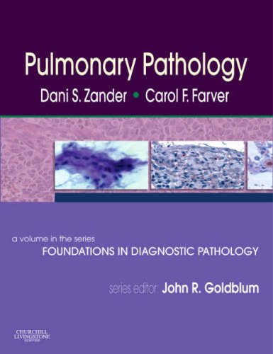 Pulmonary Pathology: A Volume in Foundations in Diagnostic  Pathology Series (Foundations in Diagnostic Pathology)