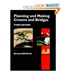 Planning and Making Crowns and Bridges