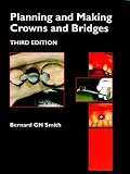 Planning and Making Crowns and Bridges