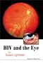 HIV and the Eye