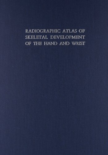 Radiographic Atlas of Skeletal Development of the Hand and Wrist by William Greulich (June 01,1999)