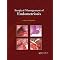 Understand Endometriosis Better