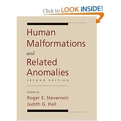 Human Malformations and Related Anomalies, 2nd edition