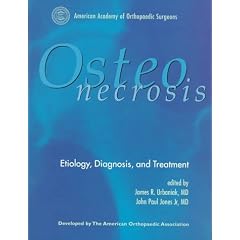 Osteonecrosis: Etiology, Diagnosis, and Treatment by James R. Urbaniak and John Paul, Jr. Jones