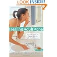 Healing Adult Acne: Your Guide To Clear Skin And Self-confidence
