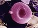 Color Enhansed Red Blood Cell in a Blood Vessel Photographic Poster Print, 16x12