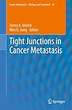 Tight junctions in cancer metastasis