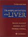 Books : Transplantation of the Liver