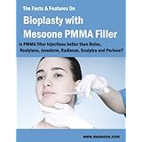 The Facts & Features On Bioplasty with Mesoone PMMA Filler. Is PMMA filler Injection better than Botox, Restylane, Juvederm