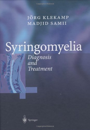 Syringomyelia: Diagnosis and Treatment