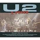 U2 X-Posed