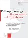 Clinical Management of Thrombotic and Cardiovascular Disorders With Thrombin Inhibitors, the Role of Argatroban: The Role of Argatroban (Pathophysiology of Haemostasis and Thrombosis)