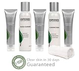 Exposed Acne Treatment - Expanded Kit Exposed Acne Treatment - Expanded Kit