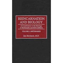 Reincarnation and Biology: A Contribution to the Etiology of Birthmarks and Birth Defects: 1