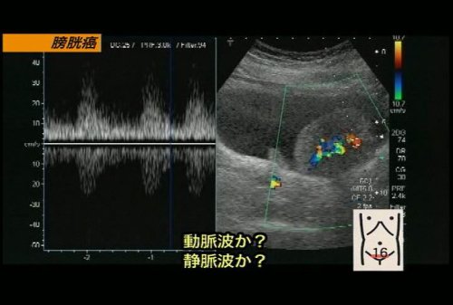 “の”の字2回走査法で出来る! 超音波手技大原則〈第3巻〉 ケアネットDVD