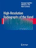 High-Resolution Radiographs of the Hand