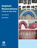 Implant Restorations: A Step-by-Step Guide