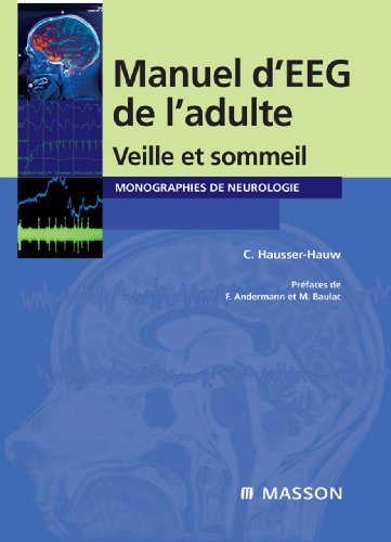 Manuel d'EEG de l'adulte: Veille et sommeil (French Edition)