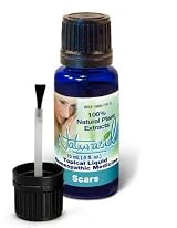 Scars Natural Treatment By Naturasil