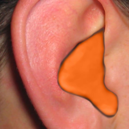 Radians Custom Molded Earplugs - Orange