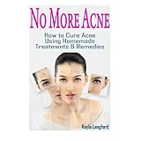 no more acne how to cure acne using homemade treatments  remedies