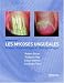 Books : Onychomycosis/Les Mycoses Ungueales: Etapes Diagnostique Et Clinique