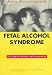 Fetal Alcohol Syndrome     **ISBN: 9781557662835**