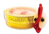 Chickenpox Petri Dish