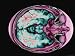 Magnetic Resonance Imaging Head at Level of Orbits Photographic Poster Print, 16x12