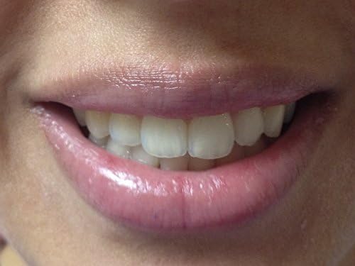 PearlBrite Teeth Whitening Pen