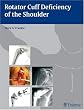 Rotator Cuff Deficiency of the Shoulder