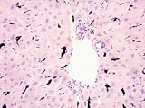 Kupffer Cells, Liver, X400 Ingesting Carbon Particles Photographic Poster Print, 32x24