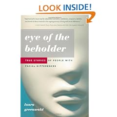 Eye of the Beholder: True Stories of People with Facial Differences