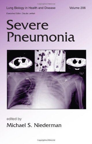 Severe Pneumonia (Lung Biology in Health and Disease) On Sale