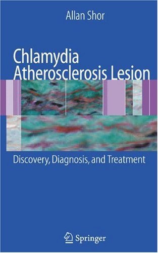 chlamydia treatment